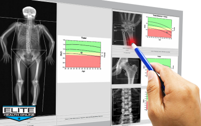 Healthy Bones and Joints