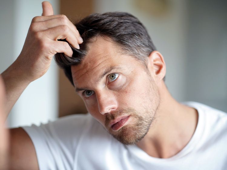 EliteHealthOnline_Hair-Loss-Solution_For_Men Hair Restoration for Men at EHO